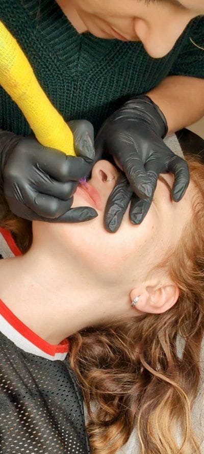 A woman receiving a lip tattoo for permanent makeup, enhancing her natural beauty with a precise and professional cosmetic procedure.