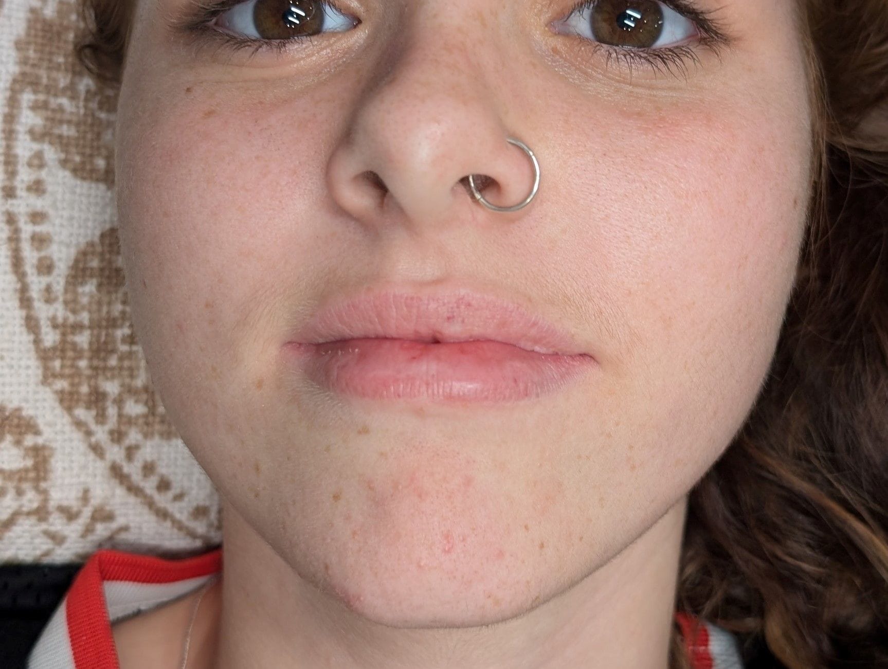 Close-up before shot of lips, showing their natural state before cosmetic tattooing.